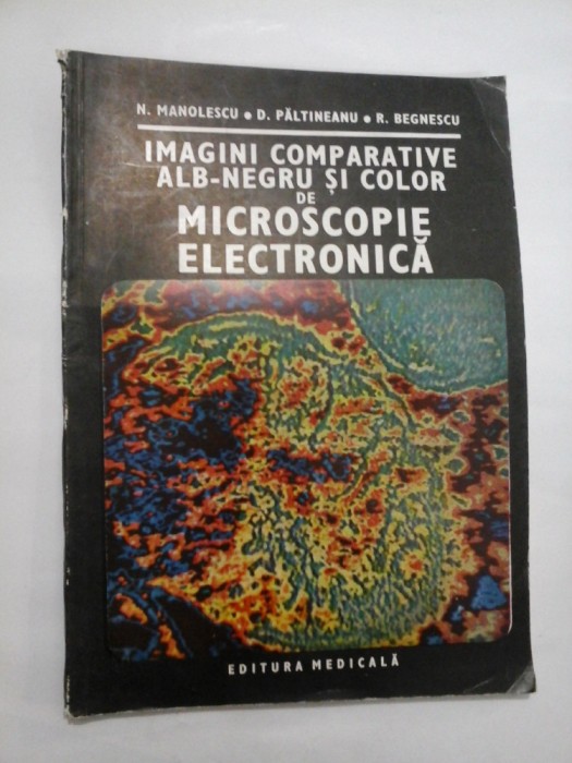 Imagini camparative alb-negru si color de microscopie electronica - N. Manolescu, D. Paltineanu, R. Begnescu