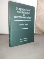 Diagnosticul morfologic al carcinoamelor - Rodica Dutu foto