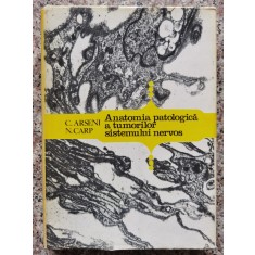 Anatomia Patologica A Tumorilor Sistemului Nervos - C. Arseni, N. Carp , B578