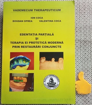 Edentatia partiala si terapia ei protetica moderna prin restaurari conjuncte - Ion Coca Bogdan Oprea Valentina Coca foto