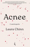 Acnee Memorii Laura Chinn Alice Books Carte Paperback Brosata Poveste Familia Fericire
