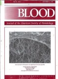 Cumpara ieftin Blood - Journal of the American Society of Hematology - 15 september 1998
