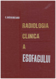 C. Margineanu - Radiologia clinica a esofagului - 126672