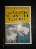 AUREL ORDEANU - RADIOLOGIA STOMACULUI TUMORAL