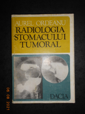 AUREL ORDEANU - RADIOLOGIA STOMACULUI TUMORAL foto