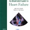 AS - JOHN G.F. CLELAND - AN ILLUSTRATED GUIDE TO HEART FAILURE, LIMBA ENGLEZA
