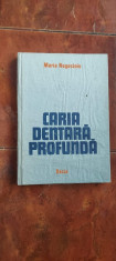 CARIA DENTARA PROFUNDA - MARIA NEGUCIOIU foto