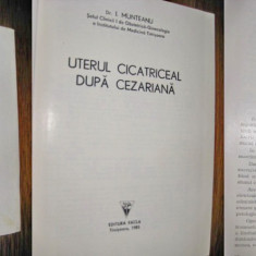 6997-I.Medicina-Munteanu-Uterul Cicatriceal dupa cezariana. Timisoara 1985.