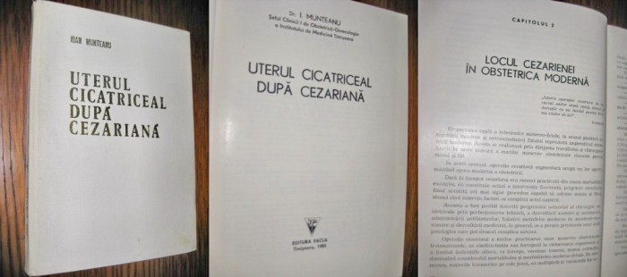 6997-I.Medicina-Munteanu-Uterul Cicatriceal dupa cezariana. Timisoara 1985.