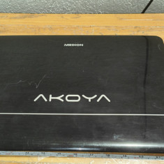 Capac Display Laptop Medion Akoya P6631 #A3515