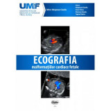 Ecografia Malformatiilor Cardiace Fetale. Brosura + DVD - Claudiu Marginean