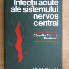 Claudiu Taindel, Ion Predescu - Infectii acute ale sistemului nervos central