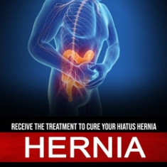 Hernia: Receive the Treatment to Cure Your Hiatus Hernia (The Natural Solution to Hiatal Hernias So You Can Get Your Health Ba