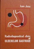 Radiodiagnosticul Clinic Ulcere Gastrice - Ioan Jocu, Editura Medicala, Romana, Anatomie, 1976