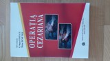 Cringu Ionescu , Mihai Dimitriu - Operatia cezariana ( 2018) obstetrica ginecologie Crangu