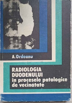 RADIOLOGIA DUODENULUI IN PROCESELE PATOLOGICE DE VECINATATE-AUREL ORDEANU-275874 foto