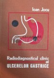 Cumpara ieftin Radiodiagnosticul clinic al ulcerelor gastrice - 1976 - Ioan Jocu (@B12)