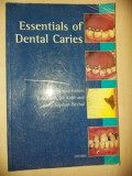 Essentials of dental caries