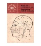 Teodor Caba, Marius Theodor Caba - Acupunctura, metoda straveche -
