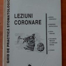 Ghid de practica stomatologica Leziuni coronare- Gheorghe Draghici