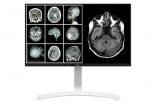 Monitor 27&quot; LG 27HJ712C-W.AEU 8MP Clinical Review