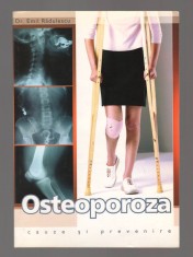 C9725 OSTEOPOROZA. CAUZE SI PREVENIRE - Dr. EMIL RADULESCU
