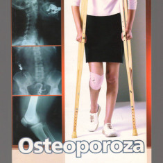 C9725 OSTEOPOROZA. CAUZE SI PREVENIRE - Dr. EMIL RADULESCU