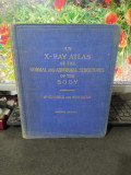 An X-Ray Atlas of the normal and abnormal structures of the body, 1927, 074