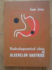 Radiodiagnosticul Clinic Al Ulcerelor Gastrice - Ioan Jocu ,298746 foto