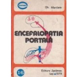 Encefalopatia portala