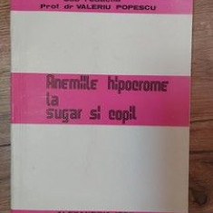 Anemiile hipocrome la sugar si copil Valeriu Popescu