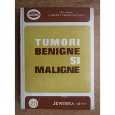 Georgeta Tarabuta Cordun - Tumori benigne si maligne volumul 1