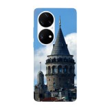 Husa compatibila cu Huawei Nova 9 model Galata Tower, Silicon, TPU, Viceversa