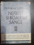 Nefrite si boale de sange-Prof.Dr.Gh.Tudoranu, Alta editura