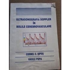 Ultrasonografia Doppler in bolile cerebrovasculare - Cornel C. Sipos