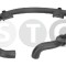 STC T498381 Furtun radiator