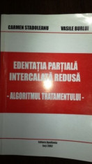Edentatia partiala intercalata redusa-Vasile Burlui foto