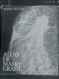 Atlas de mamografie- Maria Bucur