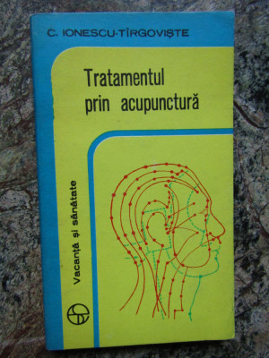 Tratamentul prin acupunctura &amp;ndash; C. Ionescu-Targoviste foto