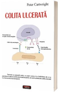 Peter Cratwright - Colita ulcerata