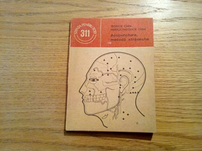ACUPUNCTURA, METODA STRAVECHE - Teodor Caba - Stiintifica, 1989, 141 p. foto