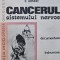 Cancerul sistemului nervos - 1982 - C. Arseni (AZ53)