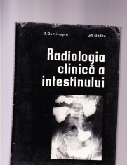 RADIOLOGIA CLINICA A INTESTINULUI foto