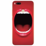 Husa silicon pentru Xiaomi Mi A1, Big Mouth