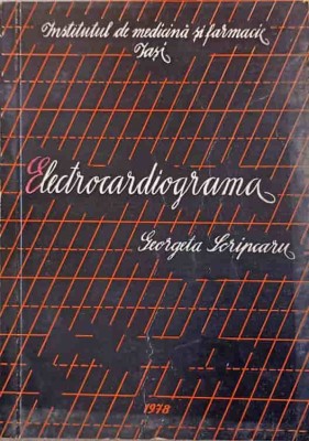 ELECTROCARDIOGRAMA-GEORGETA SCRIPCARU-254315 foto