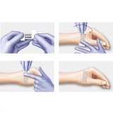 Plasturi pentru inlocuirea suturilor chirurgicale, Omnistrip, 6 x 76 mm, Hartmann