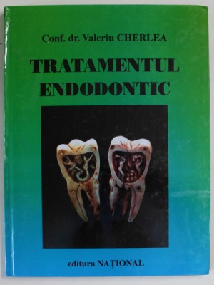 TRATAMENTUL ENDODONTIC de VALERIU CHERLEA , 2000 * EDITIE CARTONATA foto
