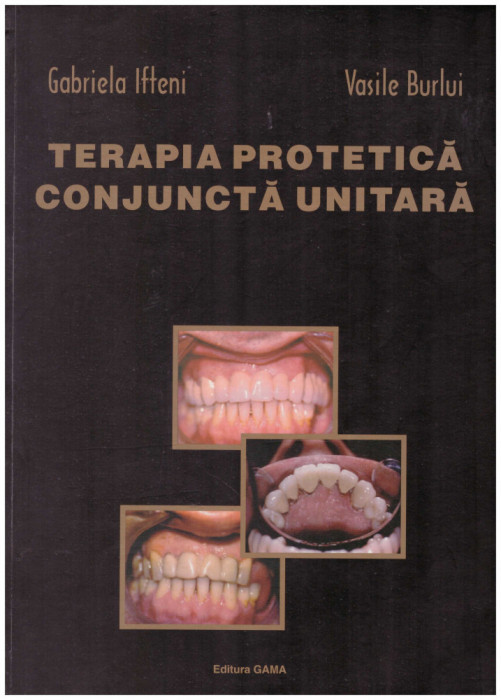 Gabriela Ifteni, Vasile Burlui - Terapia protetica conjuncta unitara - 130963