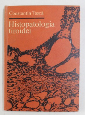 HISTOPATOLOGIA TIROIDEI de CONSTANTIN TASCA , 1978, DEDICATIE * foto