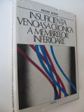 Insuficienta venoasa cronica a membrelor inferioare -